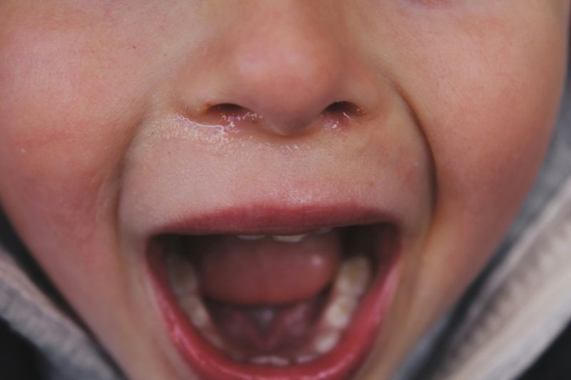 What’s the difference between a tantrum and a meltdown?
